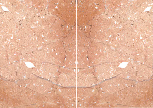 رخام روزا ميراج التركي مطابقة ربع كتاب